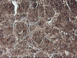 C1S Antibody in Immunohistochemistry (Paraffin) (IHC (P))