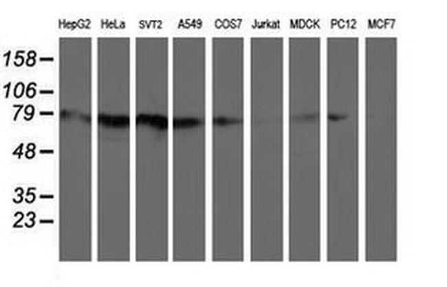 C1S Antibody in Western Blot (WB)