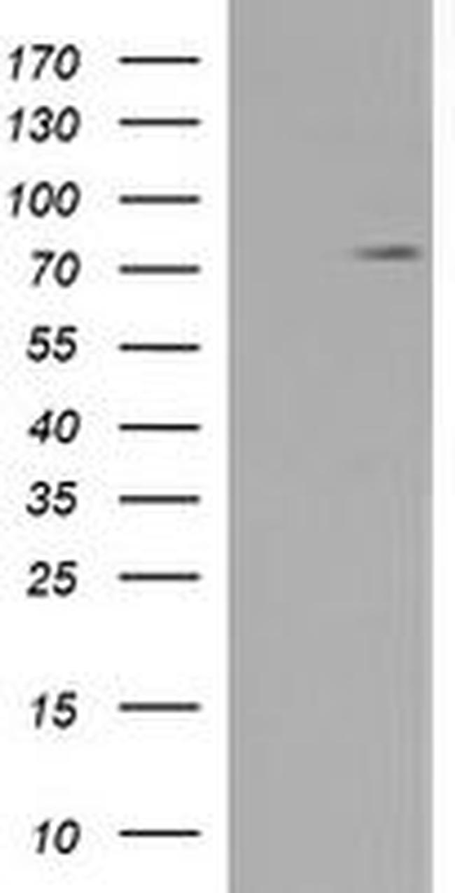 C1S Antibody in Western Blot (WB)