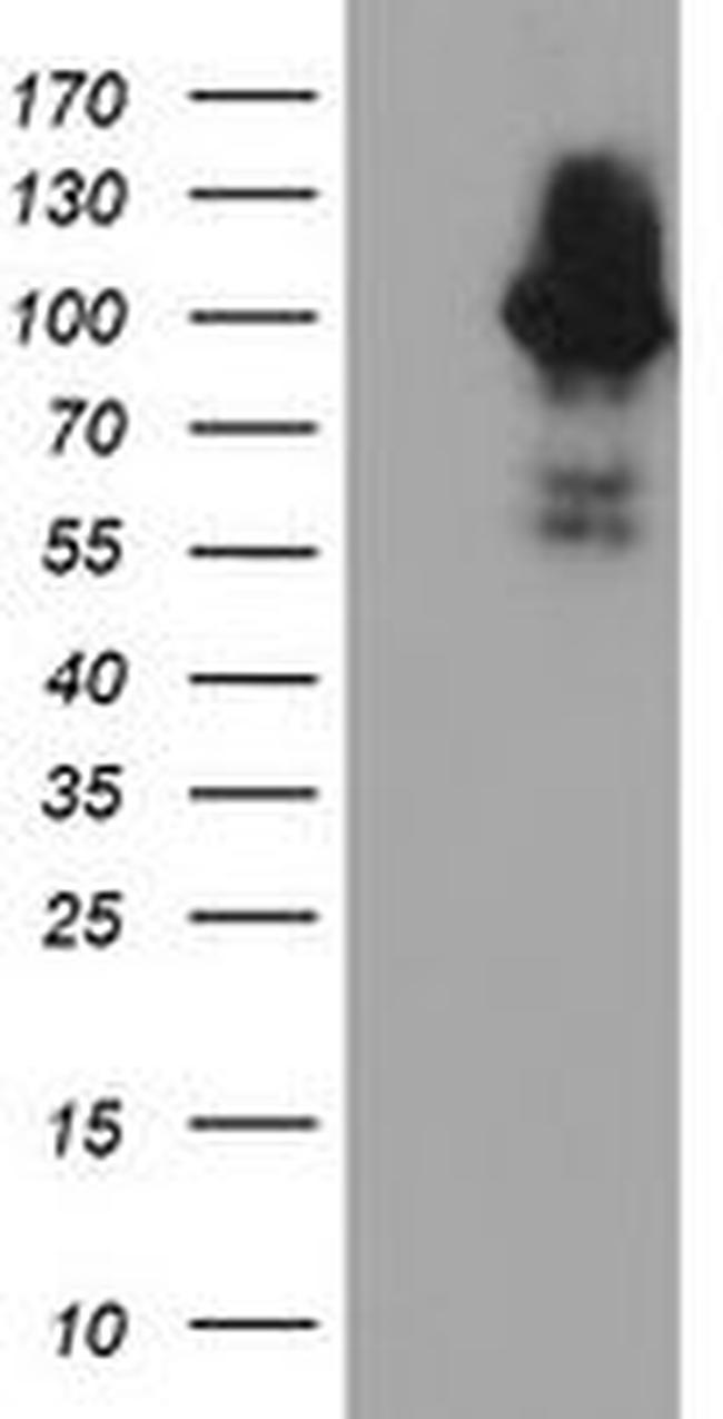 C1S Antibody in Western Blot (WB)