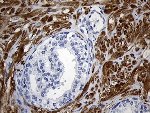 C1orf111 Antibody in Immunohistochemistry (Paraffin) (IHC (P))