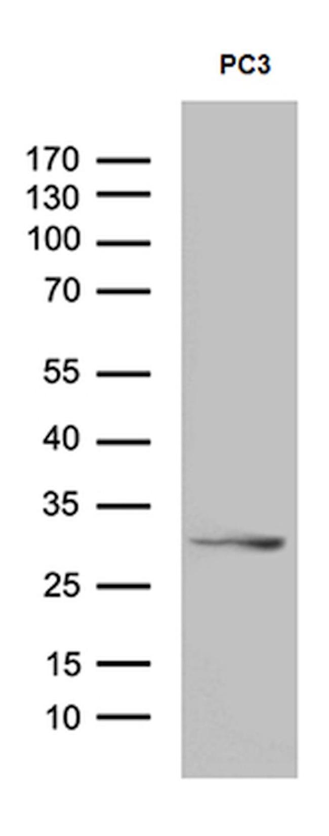 C1orf111 Antibody in Western Blot (WB)