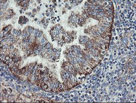 C1orf151 Antibody in Immunohistochemistry (Paraffin) (IHC (P))