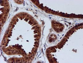 C1orf50 Antibody in Immunohistochemistry (Paraffin) (IHC (P))