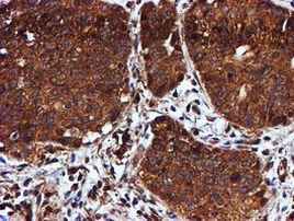 C1orf50 Antibody in Immunohistochemistry (Paraffin) (IHC (P))