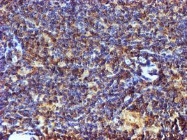 C1orf50 Antibody in Immunohistochemistry (Paraffin) (IHC (P))