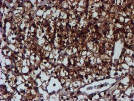 C1orf50 Antibody in Immunohistochemistry (Paraffin) (IHC (P))