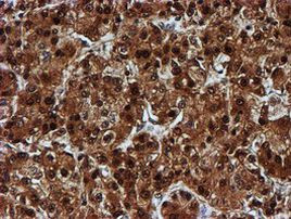 C1orf50 Antibody in Immunohistochemistry (Paraffin) (IHC (P))