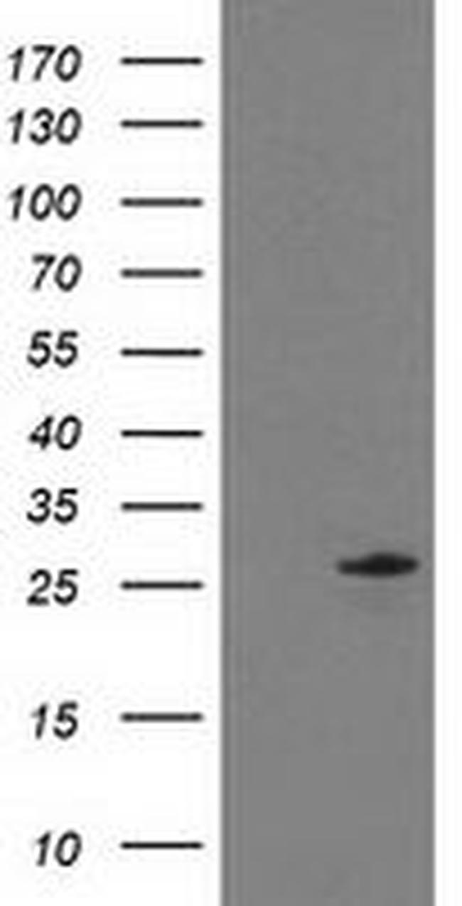 C1orf50 Antibody in Western Blot (WB)