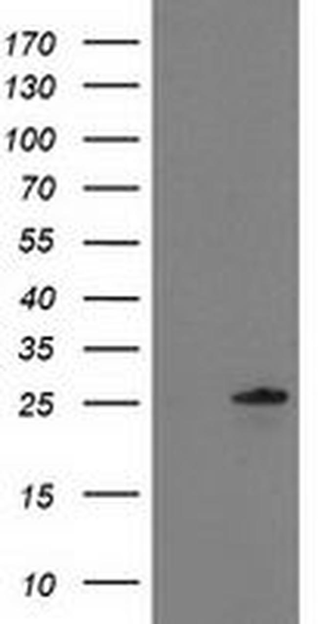 C1orf50 Antibody in Western Blot (WB)