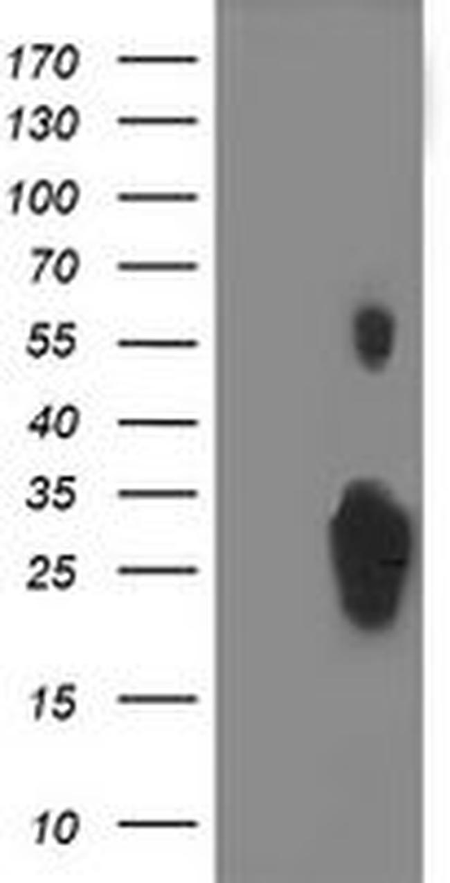 C1orf50 Antibody in Western Blot (WB)