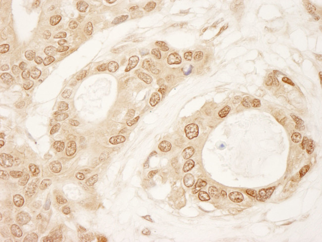 C1orf55 Antibody in Immunohistochemistry (IHC)