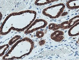 C20orf3 Antibody in Immunohistochemistry (Paraffin) (IHC (P))