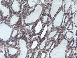 C20orf3 Antibody in Immunohistochemistry (Paraffin) (IHC (P))