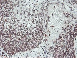 C20orf3 Antibody in Immunohistochemistry (Paraffin) (IHC (P))