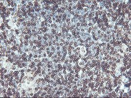 C20orf3 Antibody in Immunohistochemistry (Paraffin) (IHC (P))