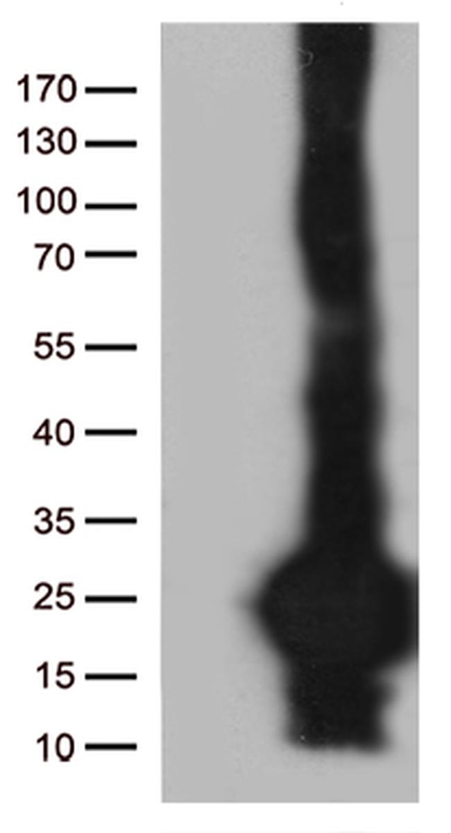 C20orf79 Antibody in Western Blot (WB)