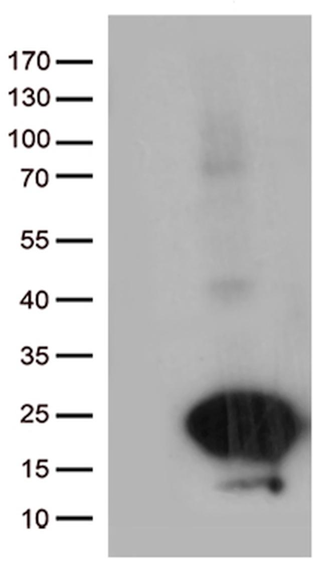 C20orf79 Antibody in Western Blot (WB)