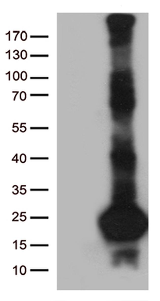 C20orf79 Antibody in Western Blot (WB)