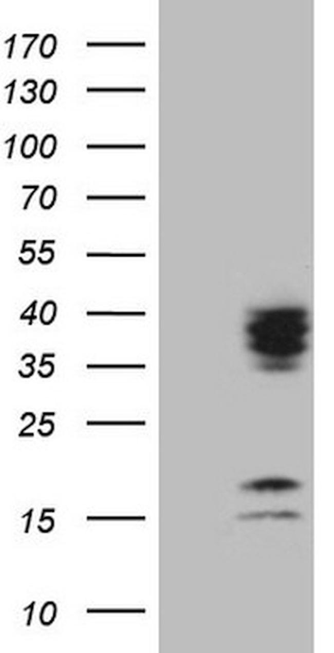 C21orf62 Antibody in Western Blot (WB)