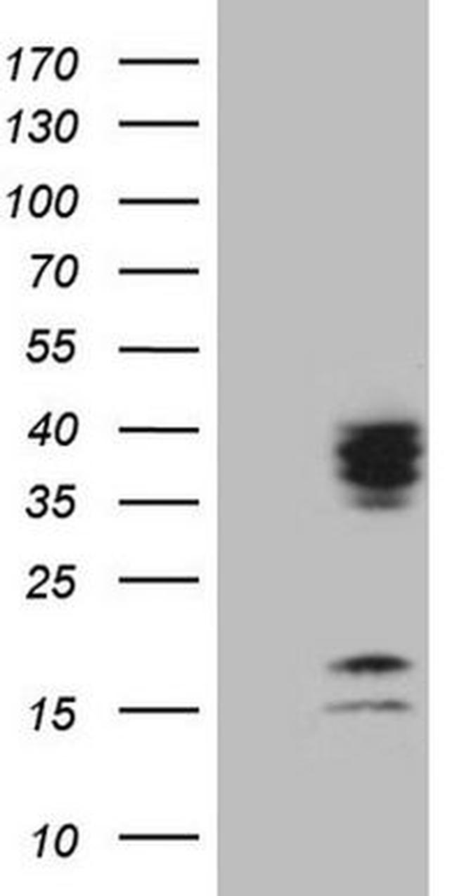 C21orf62 Antibody in Western Blot (WB)