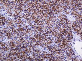 CA12 Antibody in Immunohistochemistry (Paraffin) (IHC (P))