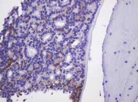 CA12 Antibody in Immunohistochemistry (Paraffin) (IHC (P))