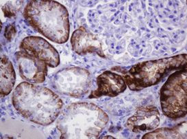 CA12 Antibody in Immunohistochemistry (Paraffin) (IHC (P))