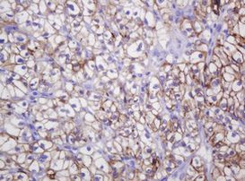 CA12 Antibody in Immunohistochemistry (Paraffin) (IHC (P))