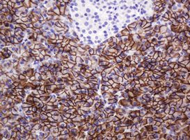 CA12 Antibody in Immunohistochemistry (Paraffin) (IHC (P))