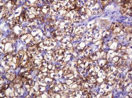 CA12 Antibody in Immunohistochemistry (Paraffin) (IHC (P))