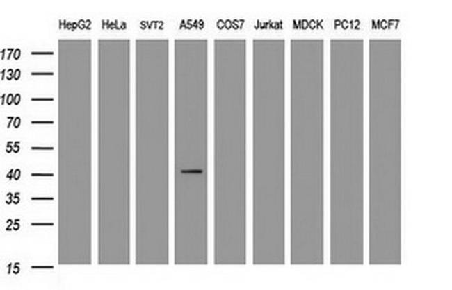 CA12 Antibody in Western Blot (WB)