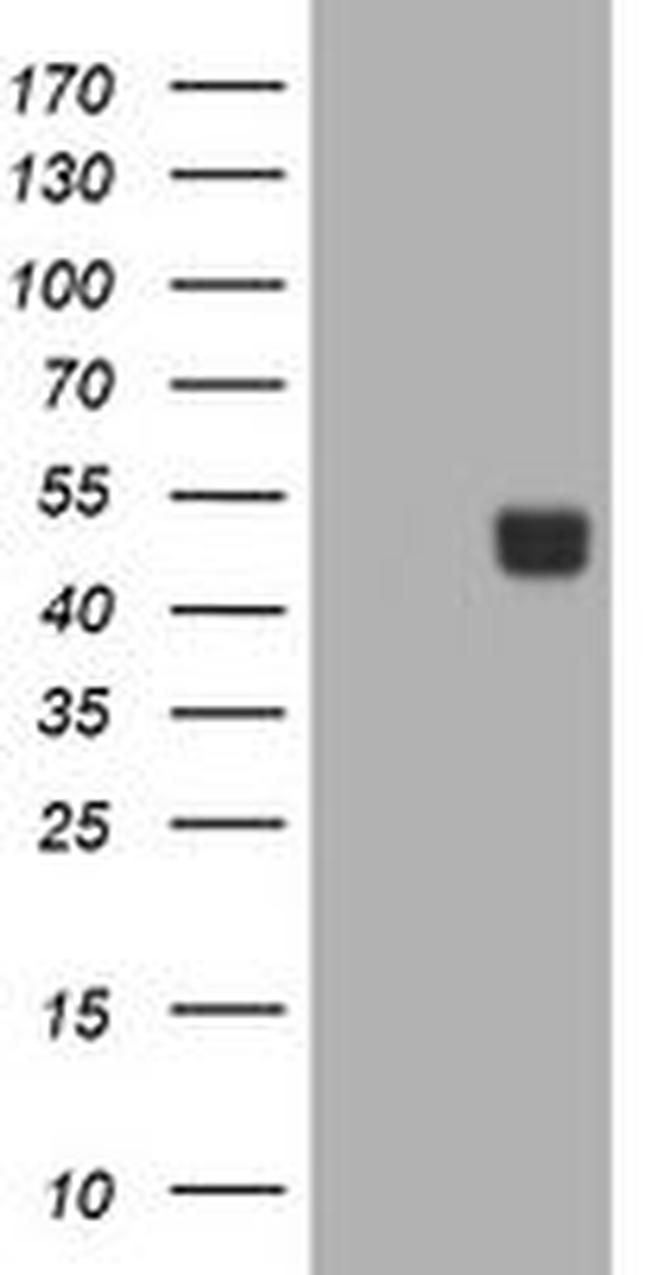 CA12 Antibody in Western Blot (WB)