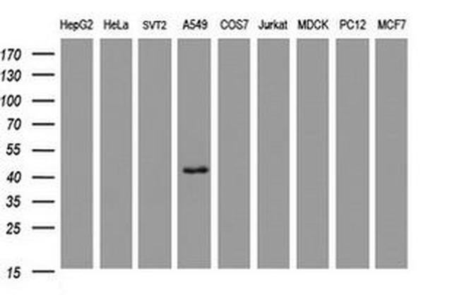 CA12 Antibody in Western Blot (WB)