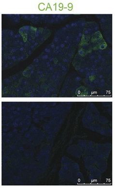 CA19-9 Antibody in Immunocytochemistry (ICC/IF)