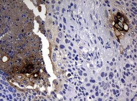 CA19-9 Antibody in Immunohistochemistry (Paraffin) (IHC (P))