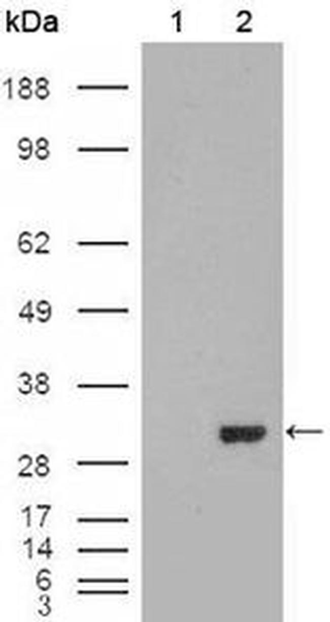 Carbonic Anhydrase I Antibody in Western Blot (WB)