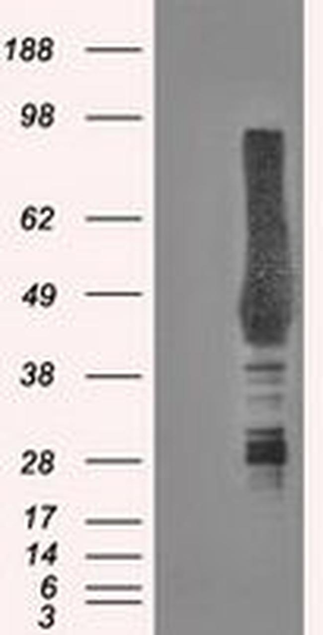 CA9 Antibody in Western Blot (WB)