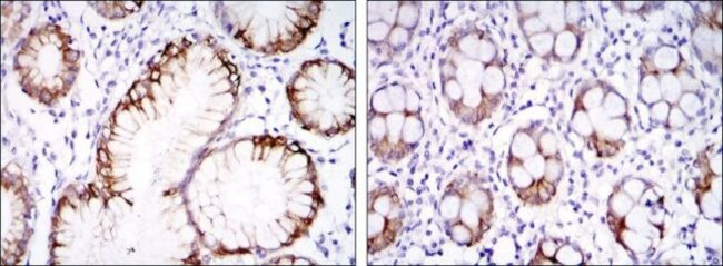 Carbonic Anhydrase IX Antibody in Immunohistochemistry (Paraffin) (IHC (P))