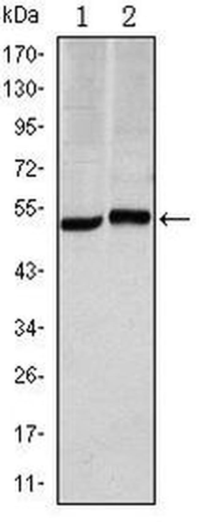 Carbonic Anhydrase IX Antibody in Western Blot (WB)