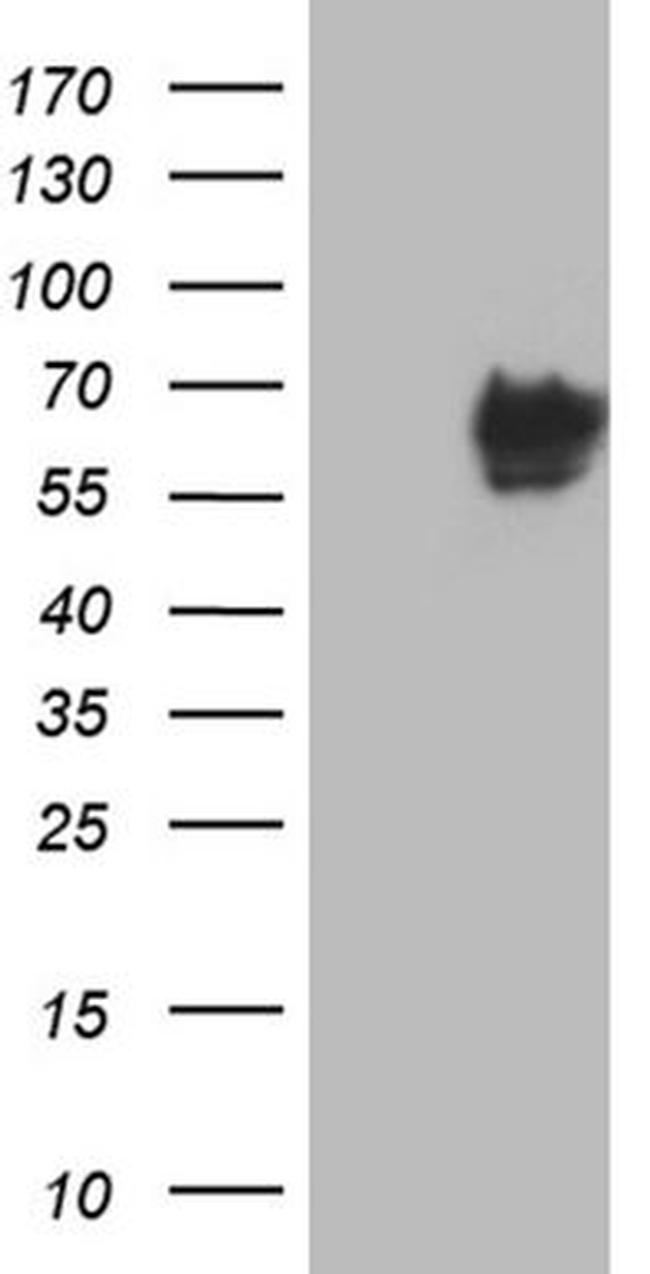 CACNB1 Antibody in Western Blot (WB)