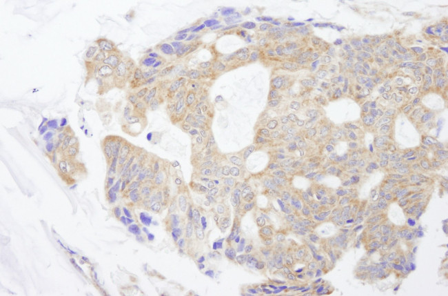 CAD Antibody in Immunohistochemistry (IHC)