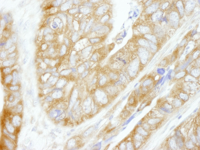 CAD Antibody in Immunohistochemistry (IHC)