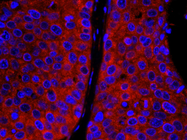 CAD Antibody in Immunohistochemistry (IHC)