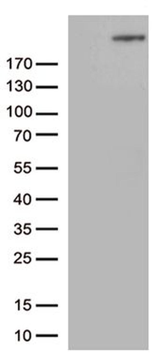 CAD Antibody in Western Blot (WB)