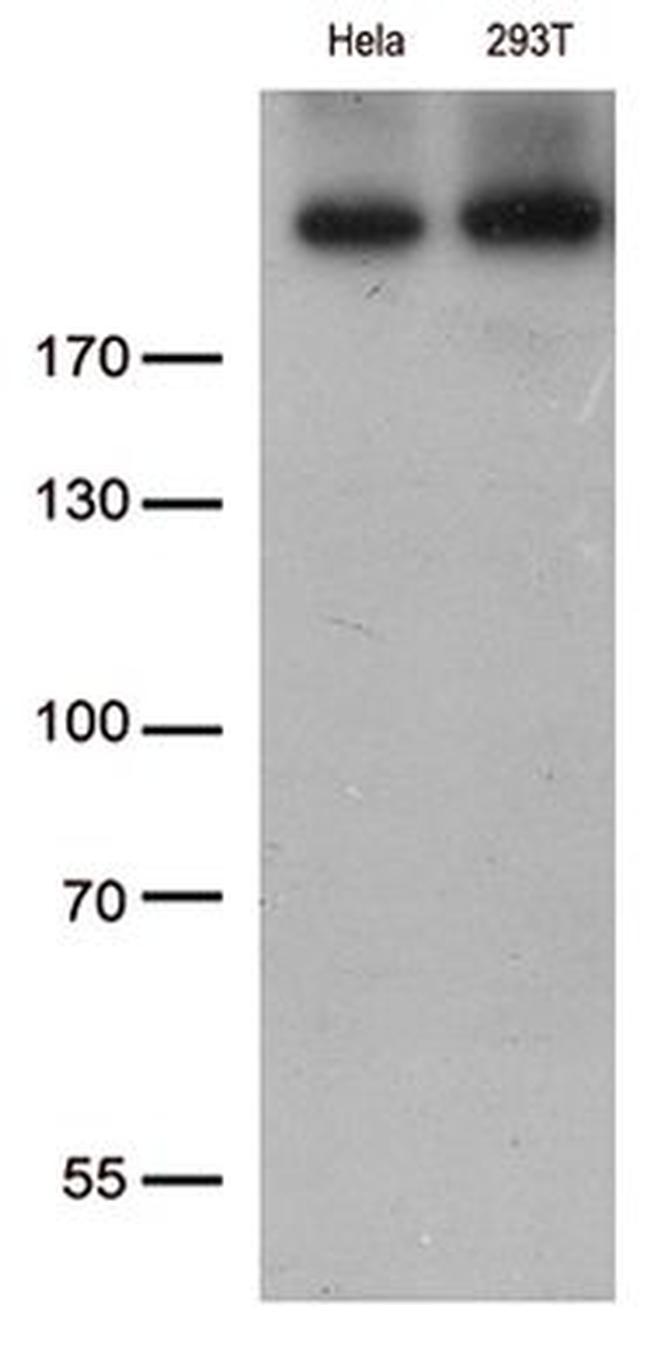 CAD Antibody in Western Blot (WB)