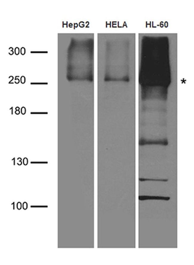 CAD Antibody in Western Blot (WB)