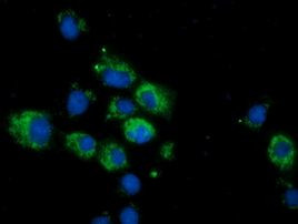 CALCOCO2 Antibody in Immunocytochemistry (ICC/IF)