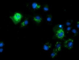 CALCOCO2 Antibody in Immunocytochemistry (ICC/IF)