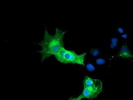 CALCOCO2 Antibody in Immunocytochemistry (ICC/IF)